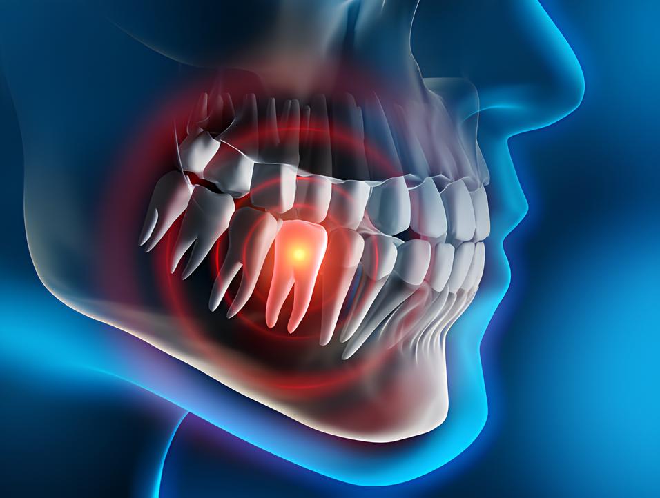 Teeth image - Emergency dentist Kingston upon Thames